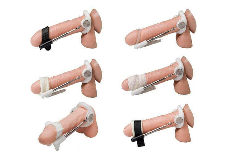 eszközök a pénisz növelésére)