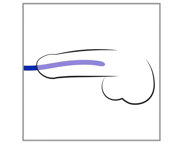 You2Toys - DILATOR - szilikon húgycső tágító dildó szett (3db)