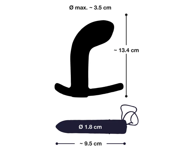 You2Toys Prostate Plug - akkus, rádiós prosztatavibrátor (fekete)
