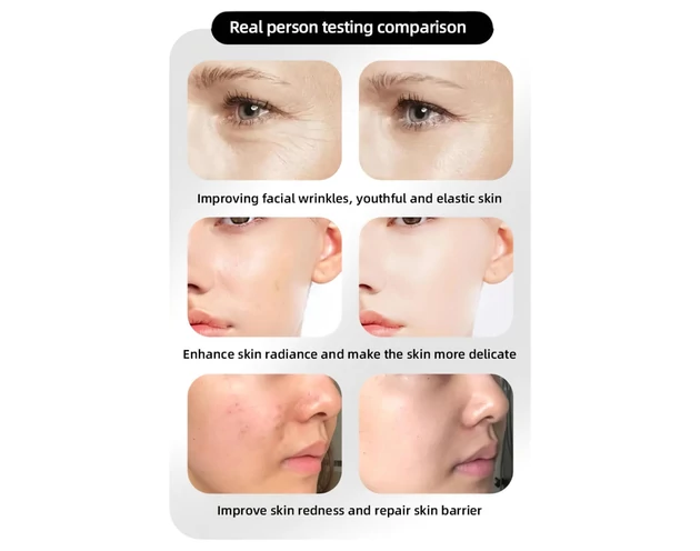 Photon Rejuvenation Arcápoló LED maszk