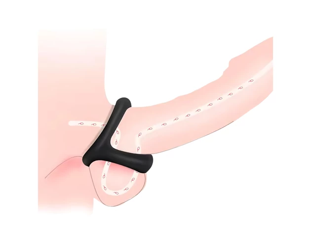 Pénisz- és heregyűrű pontozott felszínnel (fekete)